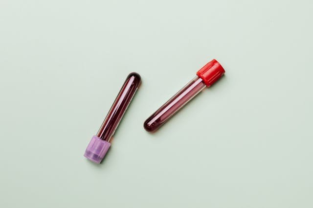 2 vials of blood 